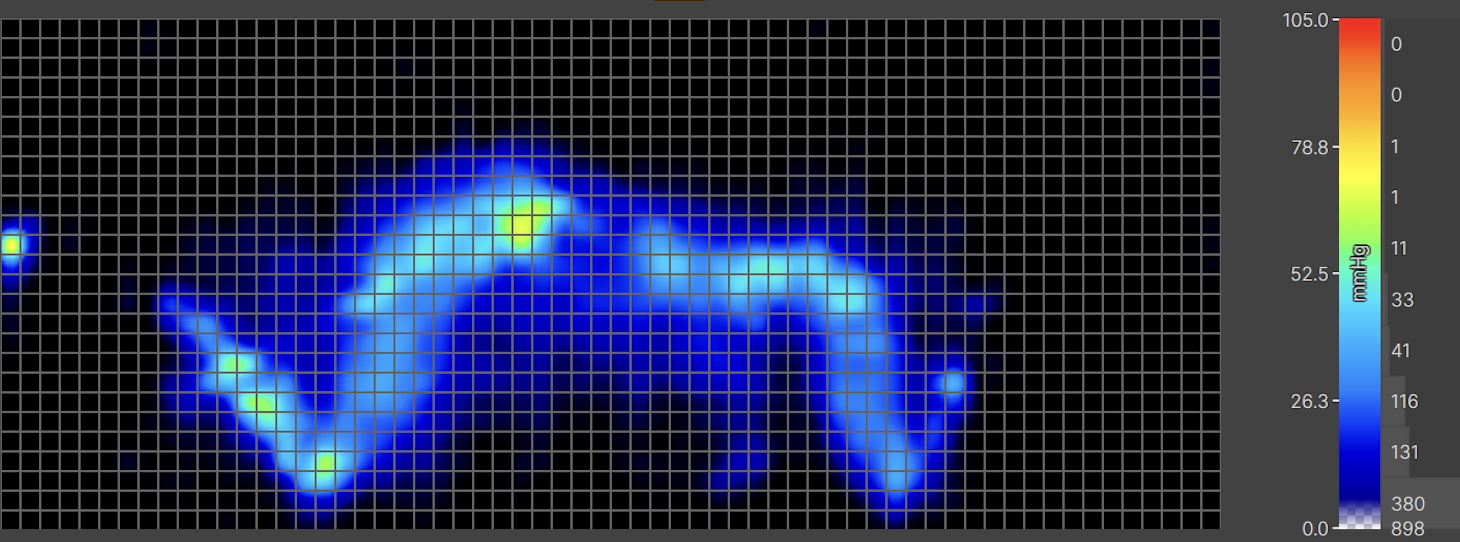 A thermal graphic displaying an average-weight sleeper lying on their side. The graphic is mostly blue, indicating low pressure buildup. That said, there's some yellow at the hips, indicating moderate pressure buildup in this area of the body.