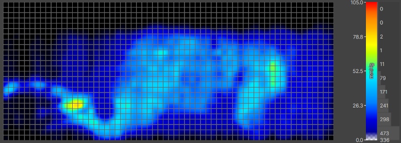 Pressure map of our heavier tester side-sleeping on a Helix Midnight Luxe mattress.