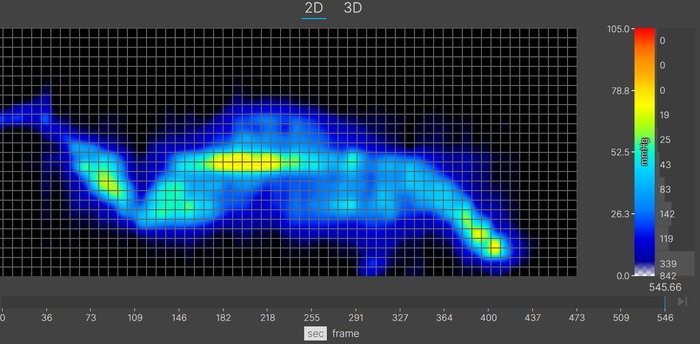A thermal graphic showing an average-weight mattress tester resting on the Layla's soft side in the side-sleeping position. The yellow at the shoulders and hips shows that there's some moderate pressure buildup in those areas.