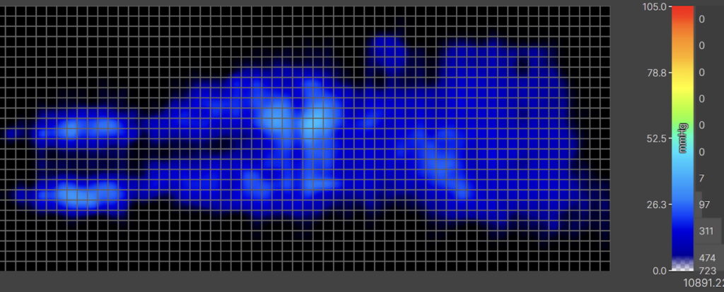 Our pressure map for the Saatva. It shows a thermal graphic of an average-weight sleeper lying on their back. The map is mostly blue, indicating low pressure buildup.