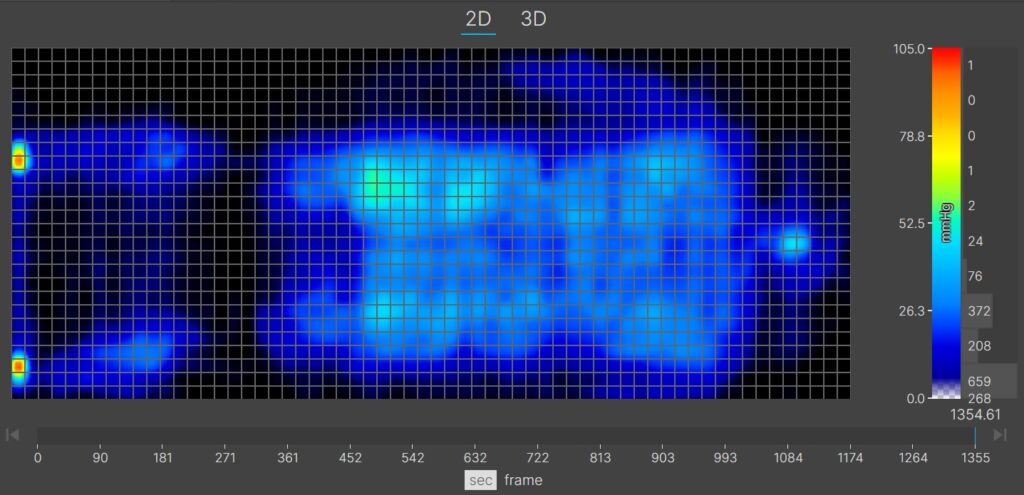 A thermal graphic showing a larger-bodied mattress tester resting on the WinkBed in the back-sleeping position. The graphic is almost entirely blue, indicating little to no pressure buildup.