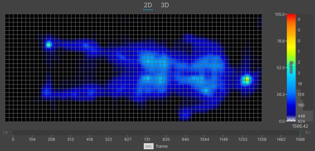 A thermal graphic showing a lightweight mattress tester resting on the WinkBed in the back-sleeping position. The graphic is almost entirely blue, indicating little to no pressure buildup.