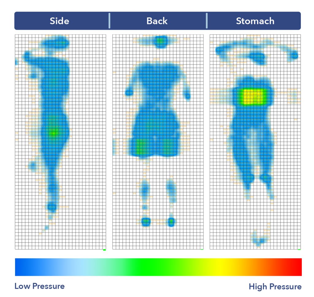 A pressure map graphic of the WinkBed EcoCloud mattress. Some pressure buildup can be seen at the shoulders while in the stomach-sleeping position.