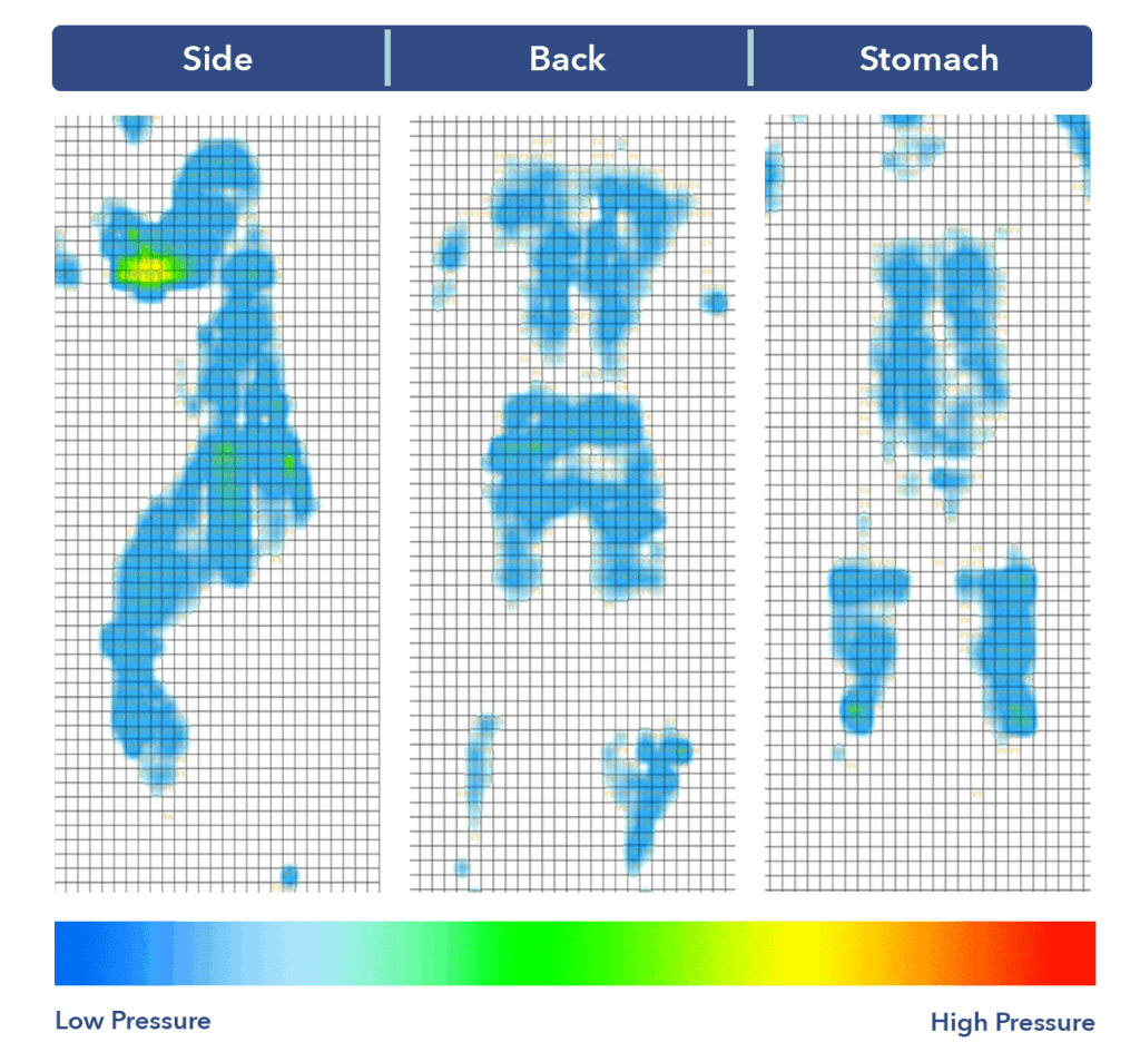 SO PressureMap Leesa
